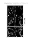 ISOLATED POPULATION OF LUMINAL STEM CELLS THAT GIVE RISE TO PROSTATE CANCER AND METHODS OF USING SAME diagram and image