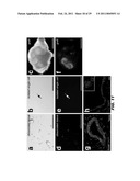 ISOLATED POPULATION OF LUMINAL STEM CELLS THAT GIVE RISE TO PROSTATE CANCER AND METHODS OF USING SAME diagram and image