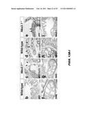 ISOLATED POPULATION OF LUMINAL STEM CELLS THAT GIVE RISE TO PROSTATE CANCER AND METHODS OF USING SAME diagram and image