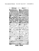 ISOLATED POPULATION OF LUMINAL STEM CELLS THAT GIVE RISE TO PROSTATE CANCER AND METHODS OF USING SAME diagram and image