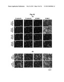 KIT FOR DETECTING CANCER CELLS METASTASIZING INTO SENTINEL LYMPH NODE diagram and image
