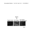 KIT FOR DETECTING CANCER CELLS METASTASIZING INTO SENTINEL LYMPH NODE diagram and image