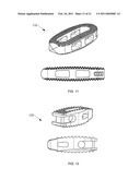 POROUS BIOCOMPATIBLE POLYMER MATERIAL AND METHODS diagram and image