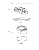 POROUS BIOCOMPATIBLE POLYMER MATERIAL AND METHODS diagram and image