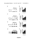 ANTI-ANGIOGENESIS, ANTICANCER PROLIFERATION PROPERTIES OF LYMPHOCYTIC-DERIVED MICROPARTICLES diagram and image