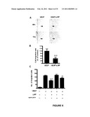 ANTI-ANGIOGENESIS, ANTICANCER PROLIFERATION PROPERTIES OF LYMPHOCYTIC-DERIVED MICROPARTICLES diagram and image