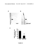 ANTI-ANGIOGENESIS, ANTICANCER PROLIFERATION PROPERTIES OF LYMPHOCYTIC-DERIVED MICROPARTICLES diagram and image