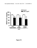 ANTI-ANGIOGENESIS, ANTICANCER PROLIFERATION PROPERTIES OF LYMPHOCYTIC-DERIVED MICROPARTICLES diagram and image