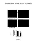 ANTI-ANGIOGENESIS, ANTICANCER PROLIFERATION PROPERTIES OF LYMPHOCYTIC-DERIVED MICROPARTICLES diagram and image