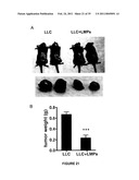 ANTI-ANGIOGENESIS, ANTICANCER PROLIFERATION PROPERTIES OF LYMPHOCYTIC-DERIVED MICROPARTICLES diagram and image