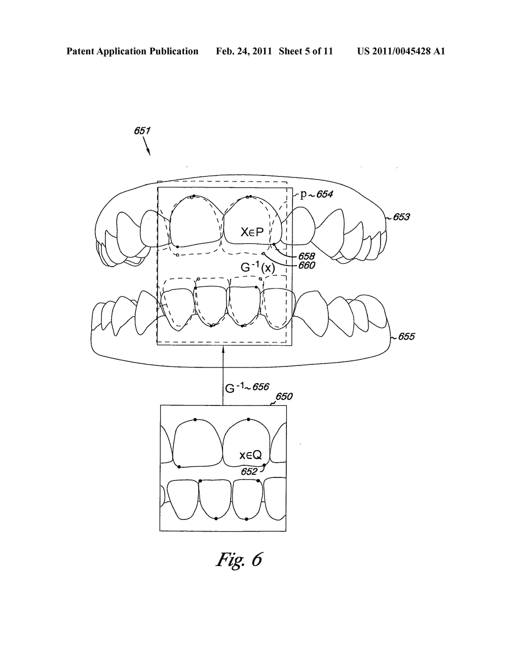 Digital dental modeling - diagram, schematic, and image 06