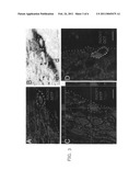 UPREGULATION OF RACK-1 IN MELANOMA AND ITS USE AS A MARKER diagram and image