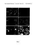 UPREGULATION OF RACK-1 IN MELANOMA AND ITS USE AS A MARKER diagram and image