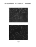 METHOD FOR DETECTING A TARGET MOLECULE IN A BIOLOGICAL SAMPLE diagram and image