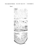 Uses of Modified ELR-CXC Chemokine G31P diagram and image