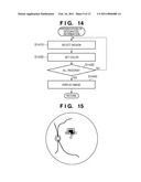 MEDICAL IMAGE PROCESSING APPARATUS AND CONTROL METHOD THEREOF diagram and image