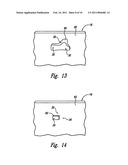 GUIDED RADIATION THERAPY SYSTEM diagram and image