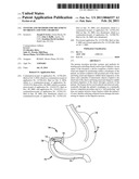 Systems and Methods for Treatment of Obesity and Type 2 Diabetes diagram and image