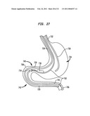 Systems and Methods for Treatment of Obesity and Type 2 Diabetes diagram and image