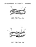 INTERNAL MEDICAL DEVICES FOR DELIVERY OF THERAPEUTIC AGENT IN CONJUNCTION WITH A SOURCE OF ELECTRICAL POWER diagram and image