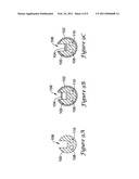 Catheter Incorporating a Guidewire Exit Ramp diagram and image