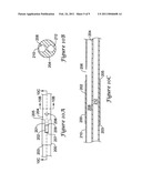 Catheter Incorporating a Guidewire Exit Ramp diagram and image