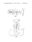 Medical Tool And Method For Forming Holes diagram and image