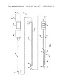 Instruments and Methods for Minimally Invasive Carpal Tunnel Release diagram and image