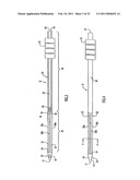 Instruments and Methods for Minimally Invasive Carpal Tunnel Release diagram and image