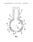 Instruments and Methods for Minimally Invasive Carpal Tunnel Release diagram and image