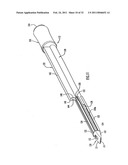 Instruments and Methods for Minimally Invasive Carpal Tunnel Release diagram and image