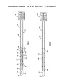 Instruments and Methods for Minimally Invasive Carpal Tunnel Release diagram and image