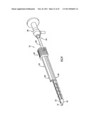 Instruments and Methods for Minimally Invasive Carpal Tunnel Release diagram and image