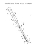 Instruments and Methods for Minimally Invasive Carpal Tunnel Release diagram and image