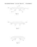 Laminoplasty System diagram and image