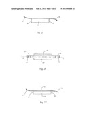 Laminoplasty System diagram and image