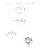 Laminoplasty System diagram and image