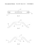 Laminoplasty System diagram and image