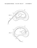 SYSTEM AND METHOD FOR ELECTRICAL STIMULATION OF THE INTERVERTEBRAL DISC diagram and image