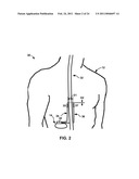 THERAPY PROGRAM MODIFICATION diagram and image