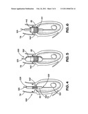 Apparatus for Implanting an Aortic Valve Prosthesis diagram and image