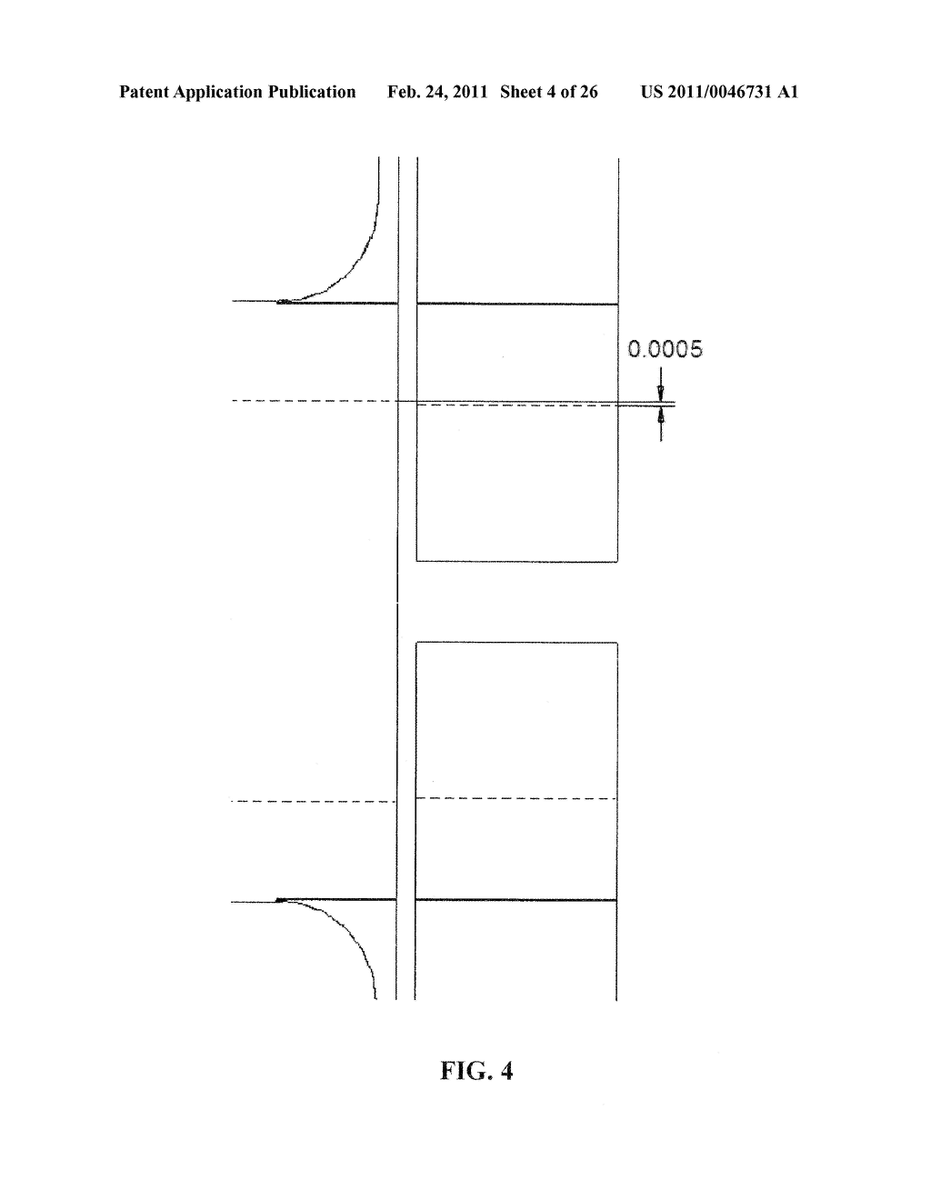 METHOD AND APPARATUS FOR IN-SITU ADJUSTABILITY OF A MIDDLE EAR PROSTHESIS - diagram, schematic, and image 05