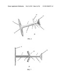 METHOD AND APPARATUS FOR IN-SITU ADJUSTABILITY OF A MIDDLE EAR PROSTHESIS diagram and image