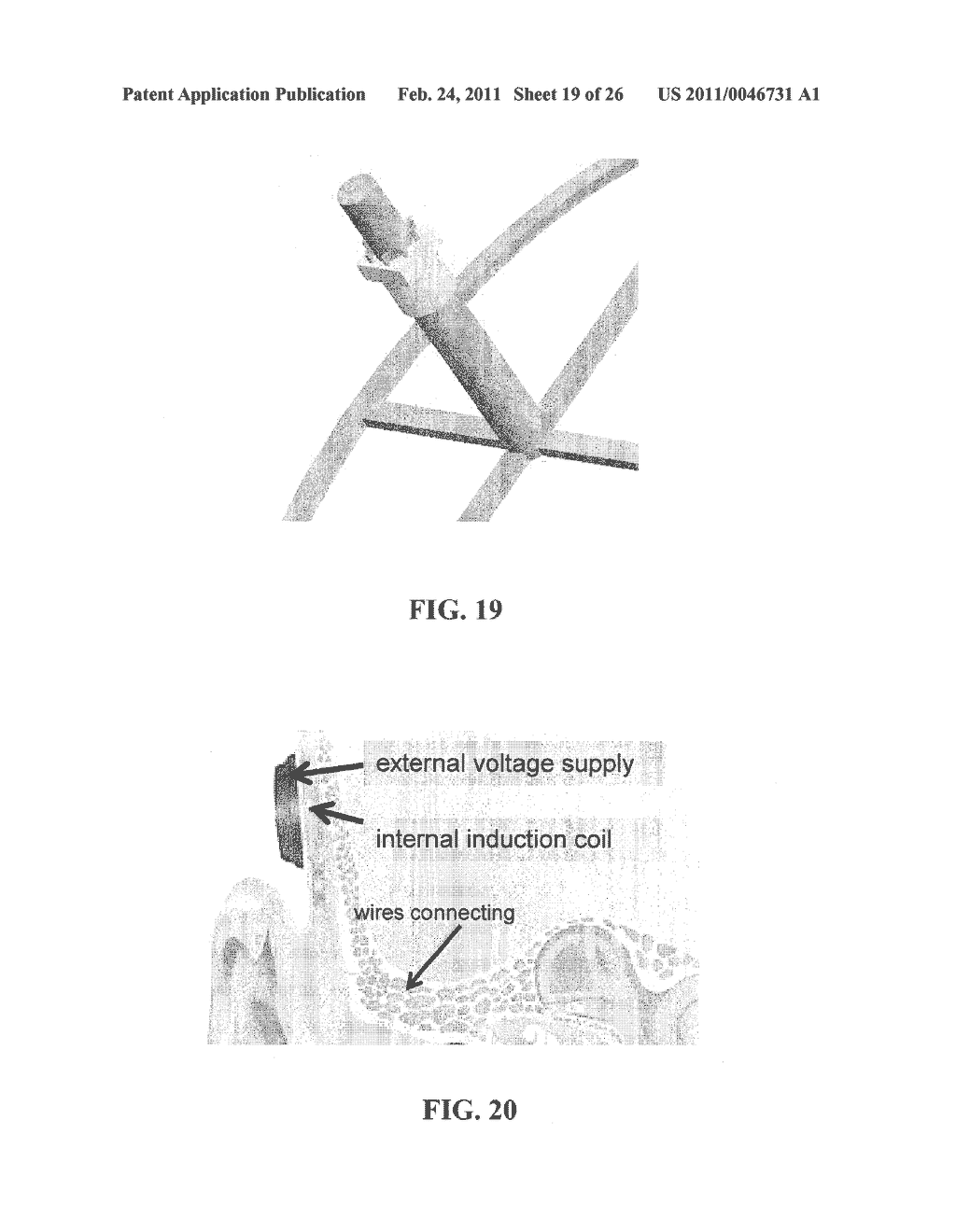 METHOD AND APPARATUS FOR IN-SITU ADJUSTABILITY OF A MIDDLE EAR PROSTHESIS - diagram, schematic, and image 20