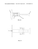 METHOD AND APPARATUS FOR IN-SITU ADJUSTABILITY OF A MIDDLE EAR PROSTHESIS diagram and image