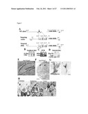 HEAT SHOCK PROTEIN DEFICIENCIES AS MODEL SYSTEMS FOR BRAIN PATHOLOGY AND CANCER diagram and image