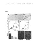 HEAT SHOCK PROTEIN DEFICIENCIES AS MODEL SYSTEMS FOR BRAIN PATHOLOGY AND CANCER diagram and image