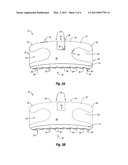 LASER SHAPED GREEN METAL BODY AND ORTHODONTIC BRACKET diagram and image