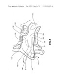 Nostril Inserts diagram and image