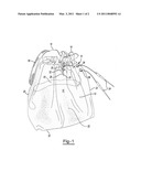 KNITTING CONTAINMENT DEVICE diagram and image